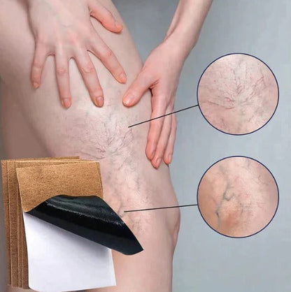 PARCHES PARA VARICES