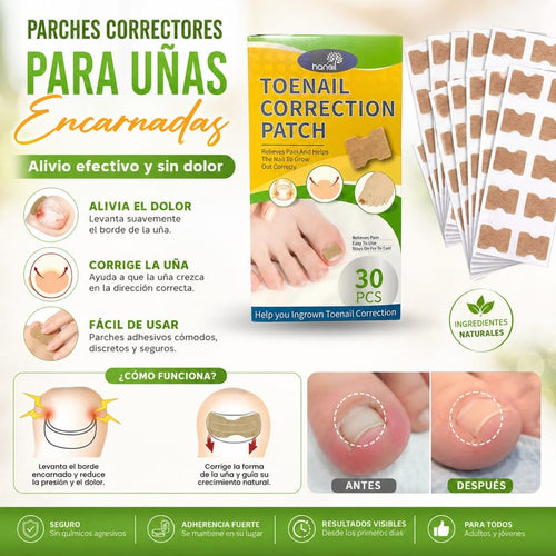 CORRECTOR UÑA ENCARNADA + ENVÍO GRATIS + DESCUENTO